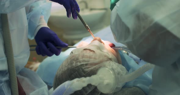 Surgical Operation to Remove a Tooth Under Anesthesia