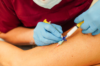 g sclerotherapy