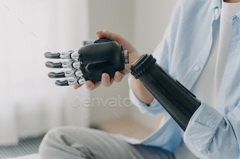 Close-up of a cutting-edge bionic hand held by a person, showcasing the latest in prosthetic technol