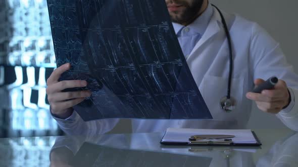 Spinal Cord Injury Specialist Examining Patients X-Ray in Office, Vertebrology