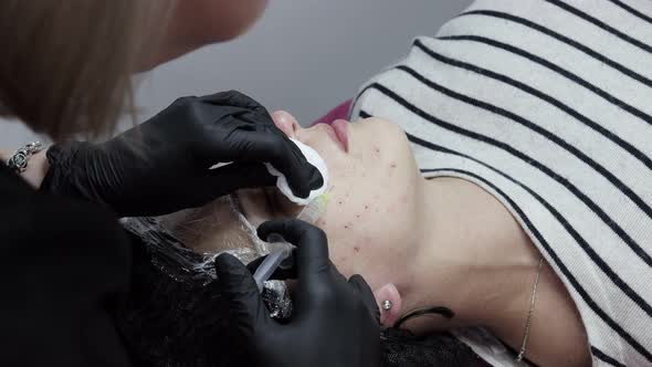 Woman on the procedure of mesotherapy injection