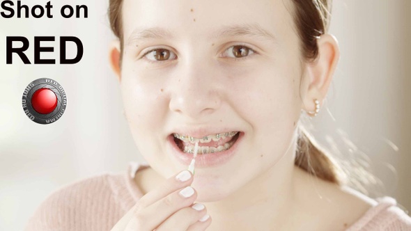 Cleaning Braces with Interdental Brush