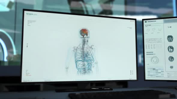 Hospital Scan Equipment Scanning Process On An Innovative Computer Program alt