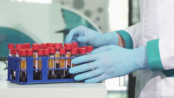 Cropped Shot of a Scientist in Protectie Gloves Working with Blood Test Tubes