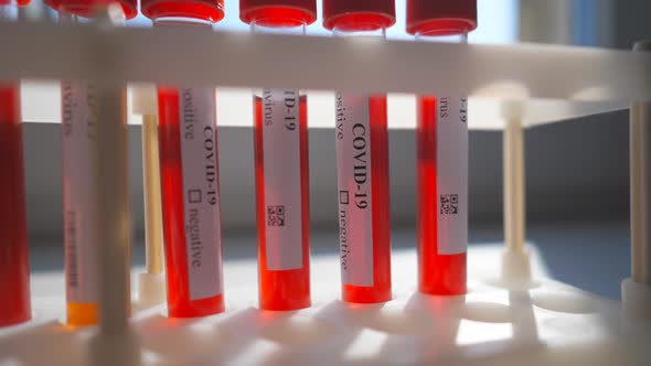 Test Tubes with Blood Samples To Coronavirus in Rack at Lab or Hospital. Laboratory Testing Blood of