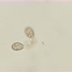 infusoria Coleps, class Ciliata, under a microscope - VideoHive Item for Sale