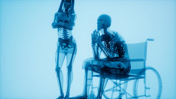 Man in Wheelchair with Visible Bones alt