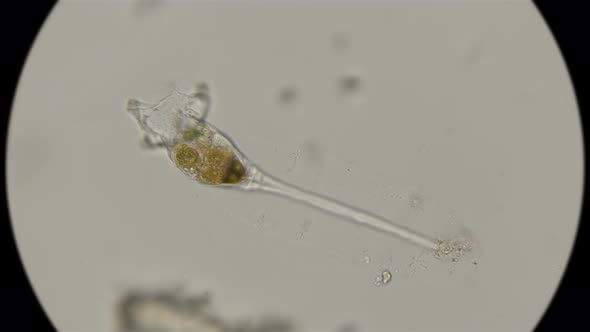 rotifer is kind of like a genus of Collotheca ornata, under a microscope 