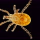 MIte of the Order Mesostigmata Under a Microscope, Class Arachnida, Superorder Parasitiformes - VideoHive Item for Sale