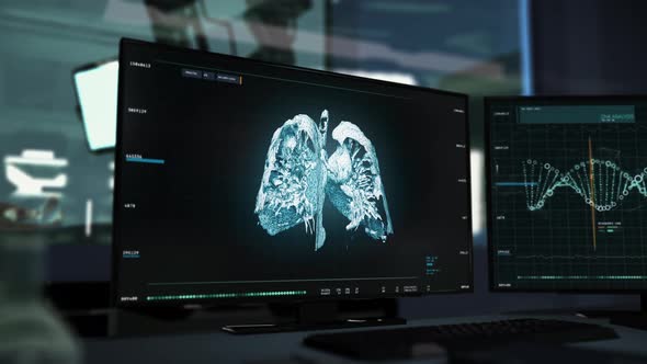 High Risk Patients Illness Oncological Analysis Via Modern Scanning Equipment alt