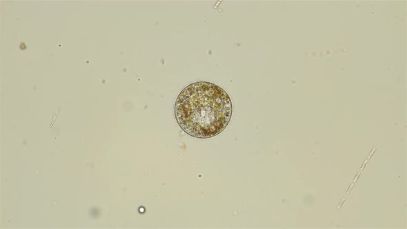 Ciliated infusoria under a microscope, Alveolata.