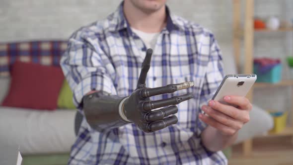 Young Man Adjusts a Prosthetic Hand with a Smartphone Close Up