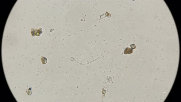 Movement of Different Types of Bacteria and Microorganisms