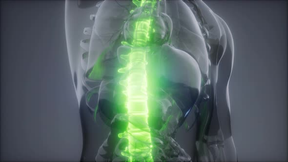 Backache in Back Bones alt