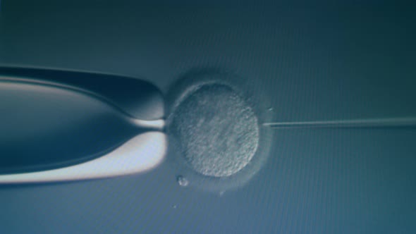 Egg Cell Is Getting Fertilized Under a Microscope. IVF, Extracorporal Fertilization Process