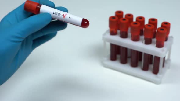 Negative G6PD Test, Doctor Showing Blood Sample, Lab Research, Health Check-Up