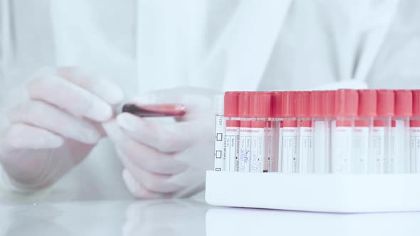 Close up laboratory worker hold blood sample in tube and place on rack.