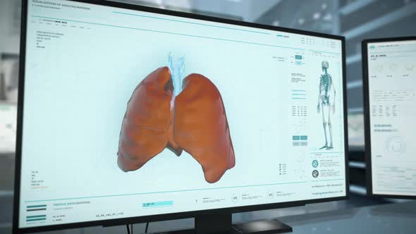 Medical Examination Of Pneumonia Affected Lungs Caused By Covid-19 Pandemic alt