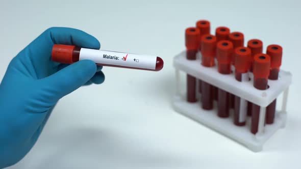 Negative Malaria Test, Doctor Showing Blood Sample, Lab Research, Healthcare