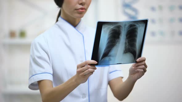 Female Physician Attentively Looking at Lungs X-Ray