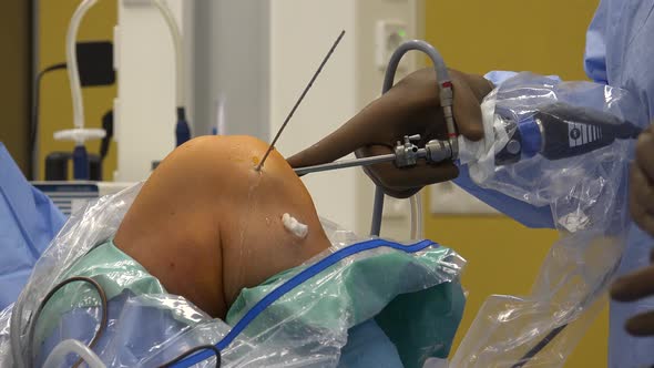 Knee Arthroscopy 7