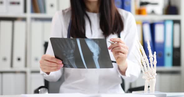 Doctor Traumatologist Looking at Xray of Hand on Background of Artificial Model of Human Palm Movie