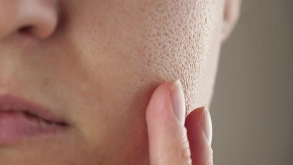 Macro Skin with Enlarged Pores