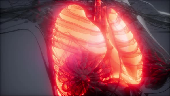Human Lungs Radiology Exam alt