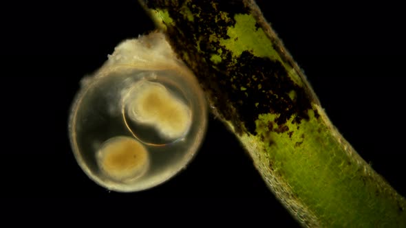 Eggs of the Cochlea Under the Microscope