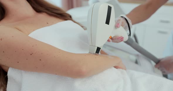 Closeup Laser Hair Removal Under the Armpit of a Beautiful Girl in a Beauty Salon