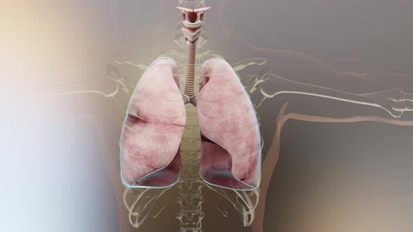 Pneumothorax, Hemothorax and Hemopneumothorax, Normal lung versus collapsed,