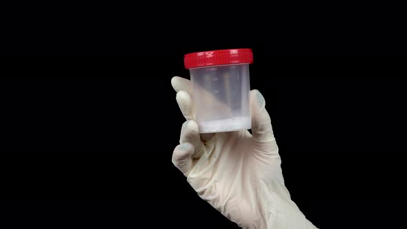 Sperm in a Test Bank Close-up. The Doctor Holds a Jar in a Glove on a Black Background.