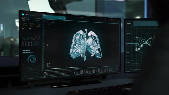 Anatomical x-ray analysis system has detected cancer in the patients lungs