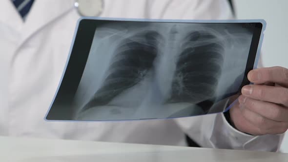 Oncology Expert Holding Healthy Patient's Lung Scan, Making Favorable Diagnosis