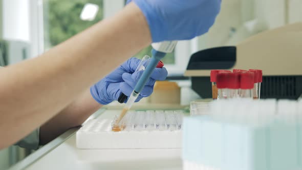 Lab Worker Is Filling Tubes with Biochemical Samples. Covid-19, Coronavirus, Coronavirus Comcept.