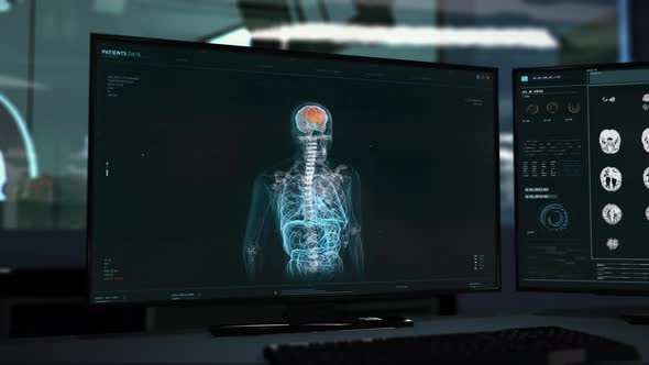 Interface of the futuristic scanner analyzing the body of the patient at the lab alt