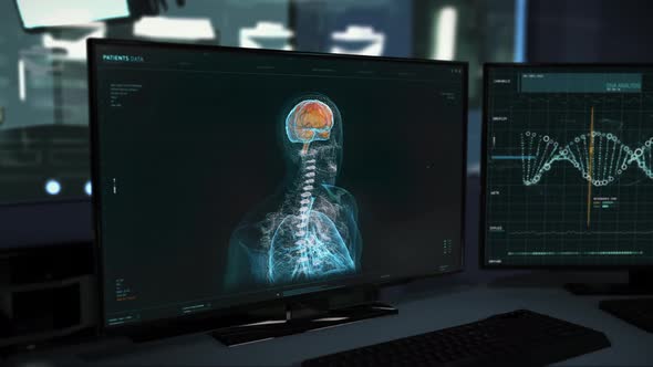 Futuristic medical examination of the patient’s brain at the health care center alt