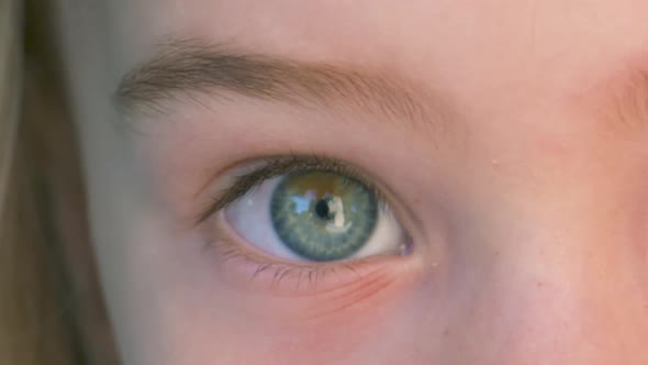 Close up of a child with two different eye colors (Partial heterochromia iridum)