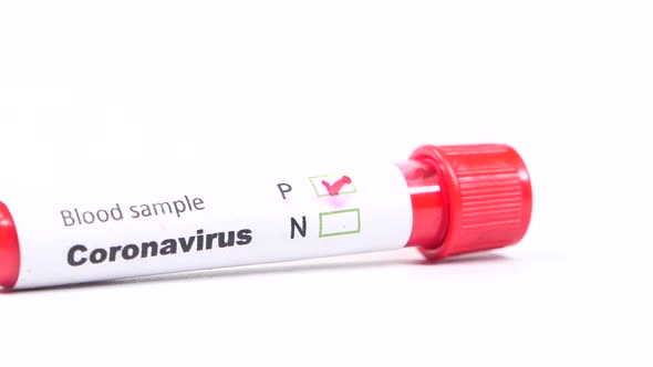 Close Up of Corona Virus Blood Test Tube on White Background 