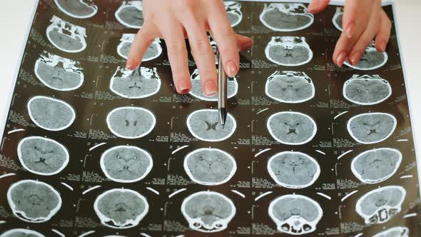 Xray Magnetic Resonance Image of Head Human Brain MRI Closeup