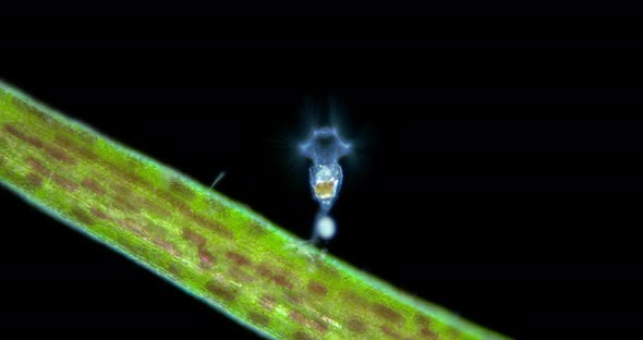Rotifera of Family Collothecidae Under a Microscope Possibly Collotheca Ornata