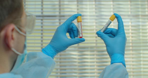 Young Male Doctor Comparing Blood Samples. Coronavirus COVID-19 Positive Blood Sample Compare.