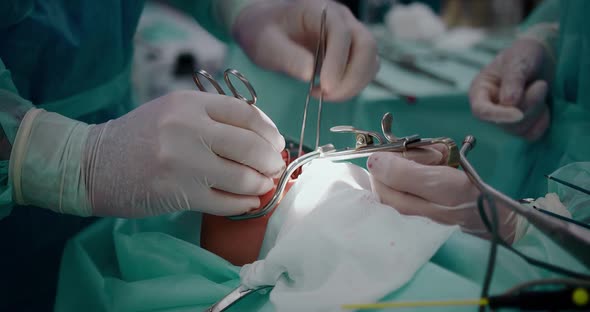 The Doctor Performs a Pediatric Surgical Operation to Remove the Tonsils