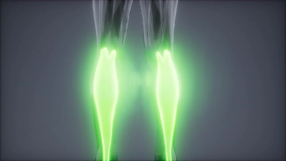 Gastrocnemius- Visible Muscle Anatomy Map alt