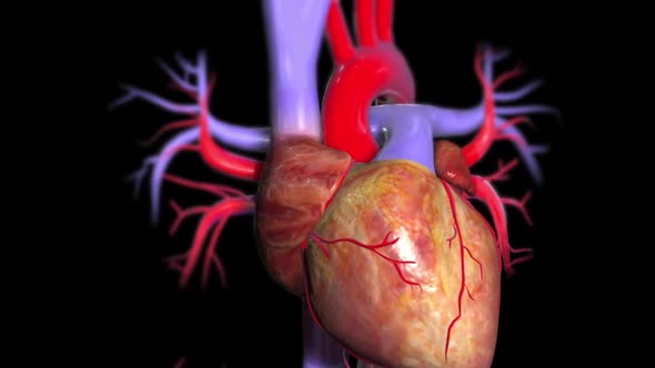 An enlarged heart can be caused by high blood pressure or coronary artery disease.
