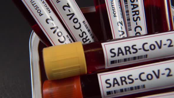 Sars Cov2 blood test tube