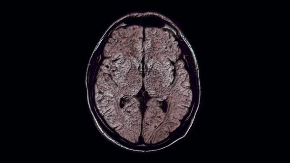 Voluminous Color MRI Scans of the Brain and Head To Detect Tumors. Diagnostic Medical Tool