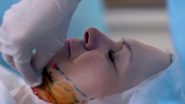 Closeup Picture of Adult Woman Lying on Table in Operating Room with Closed Eyes While Paramedic