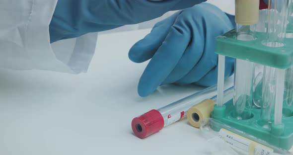 Laboratory Assistant Signs Pen Test Tubes To Collect Analysis and Further Research