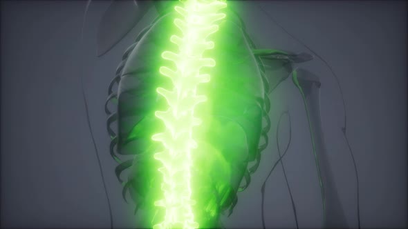 Backache in Back Bones alt